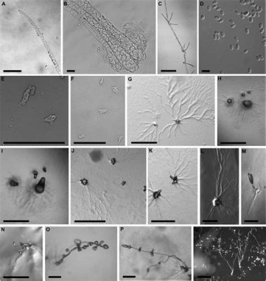  Heterostelium! An Amoebozoan Enigma That Embraces Both Solitude and Sociability