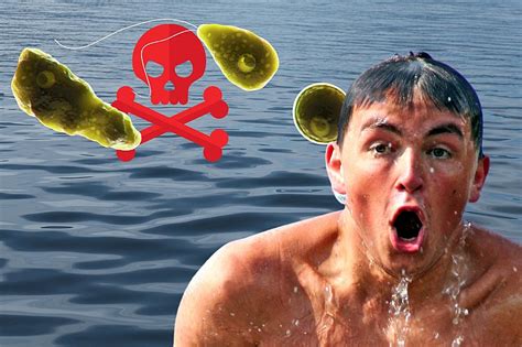  Yellow Brain Amoeba: A Microscopic Menace Lurking Within Our Waters!